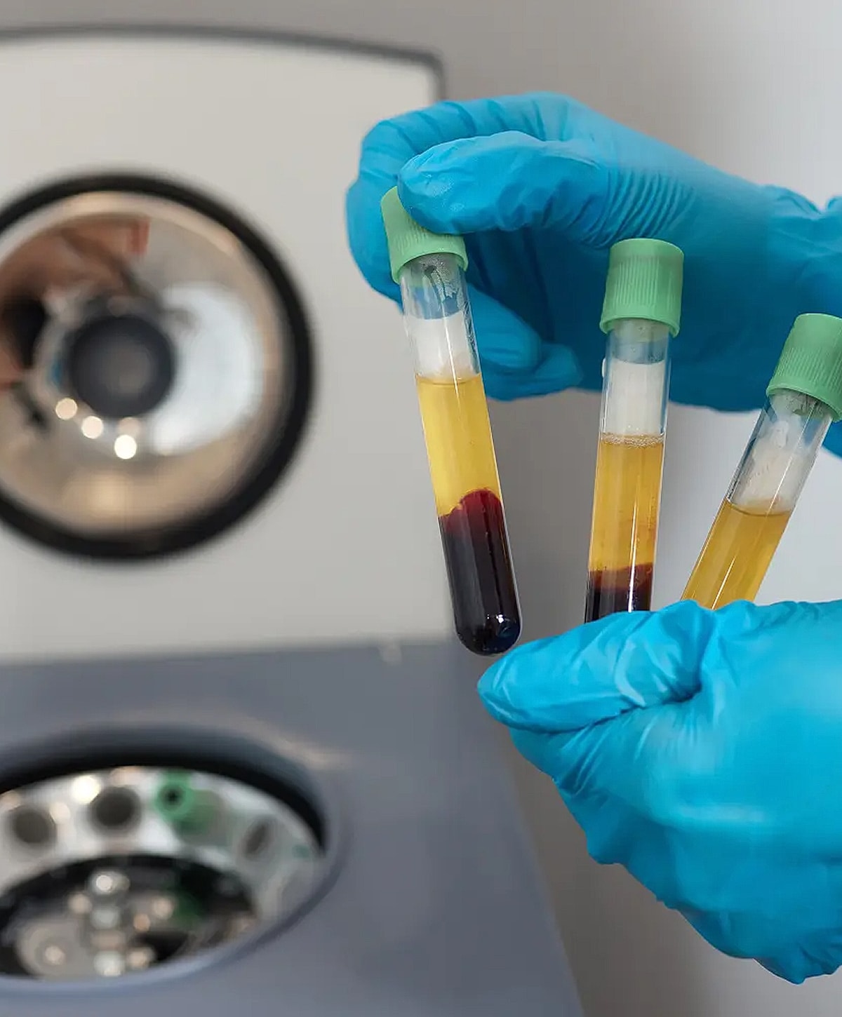 Person holding blood test tubes with centrifuge.
