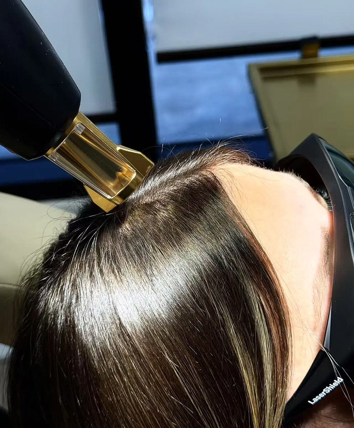 Hair treatment with laser device.