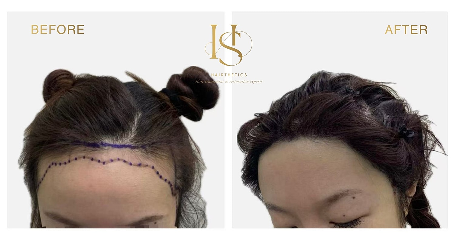 Hair transformation before and after results.