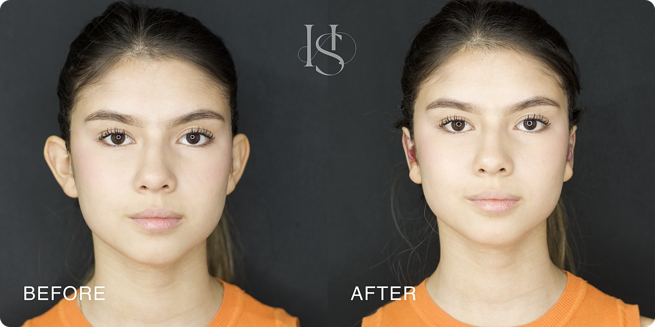 Before and after photo of facial transformation.
