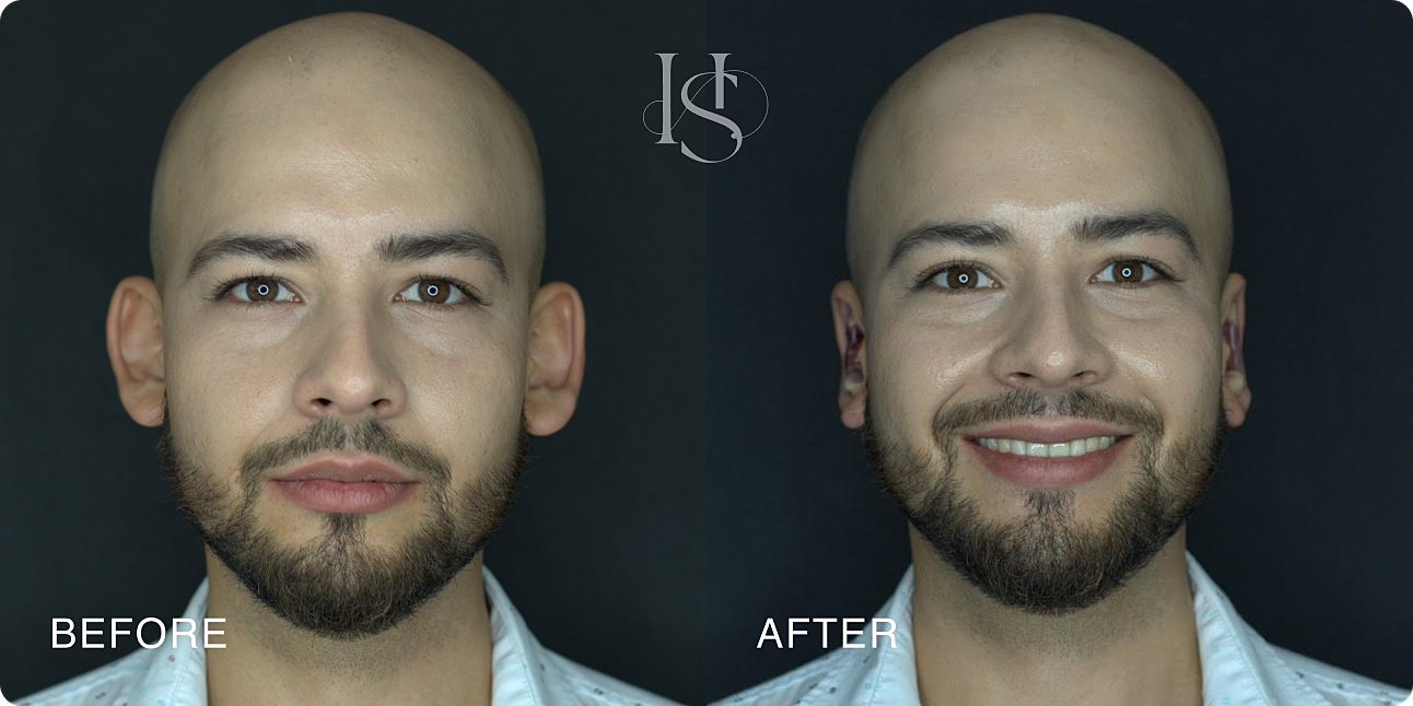Before and after transformation of a man's appearance.